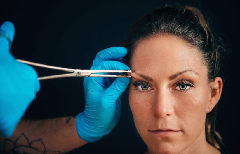 What is Plexr/Plasma Pen Treatment?