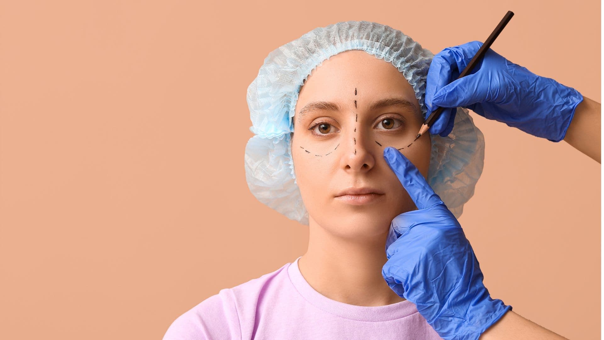 How Long Does Eyelid Surgery Last?