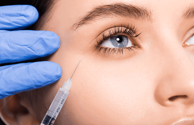 Superior Sulcus Filler