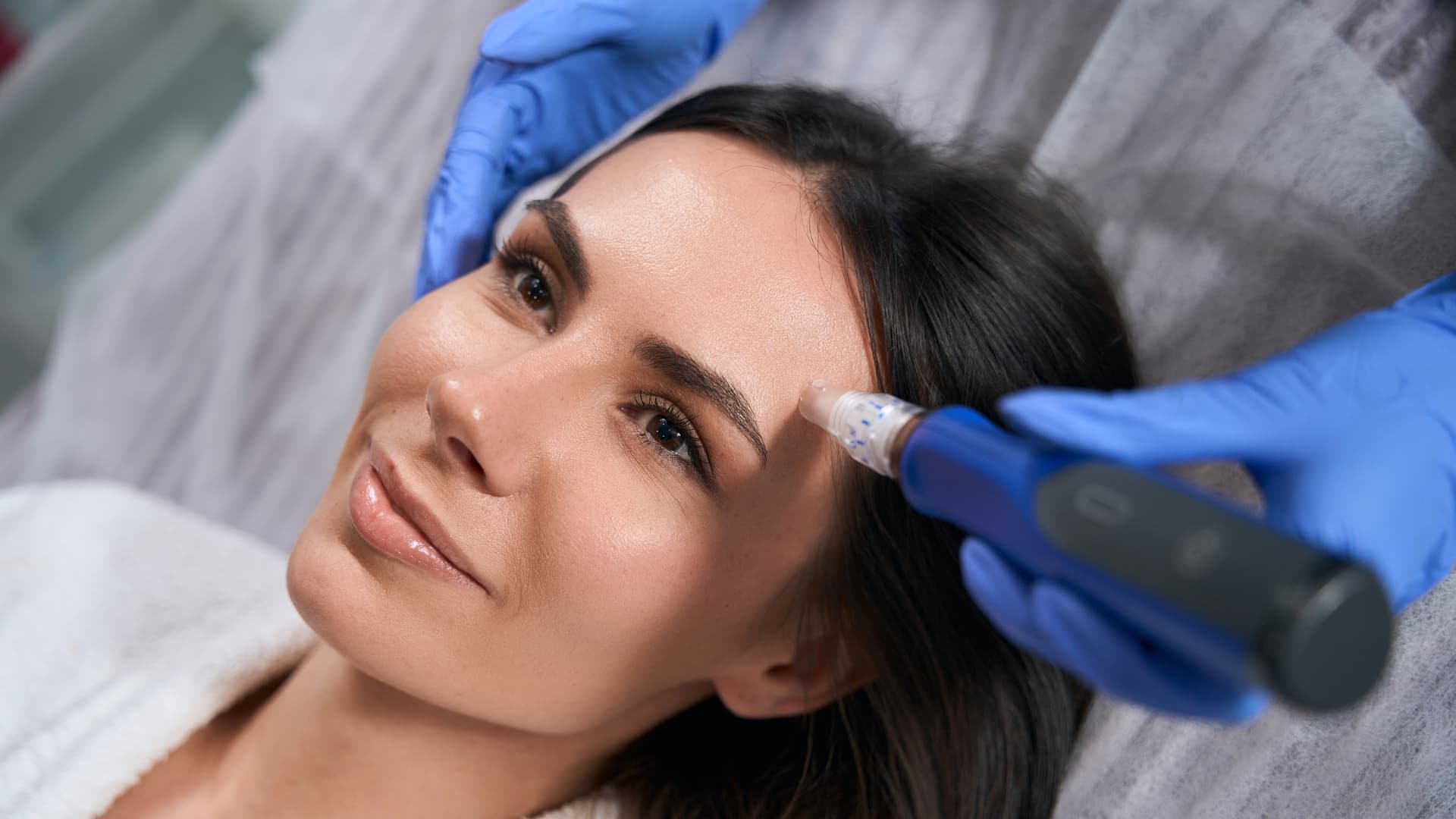 Microneedling Side Effects