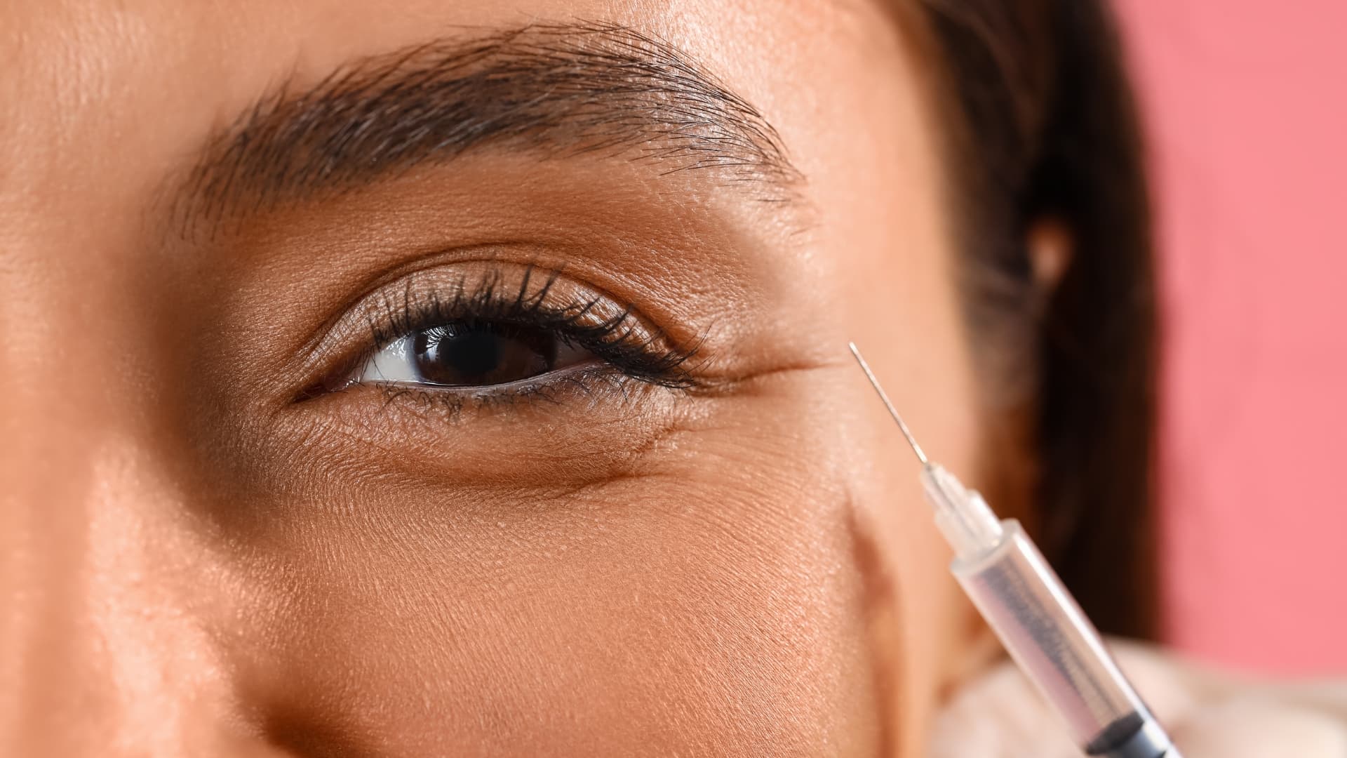 Tear Trough Filler Cost: What You Need to Know?