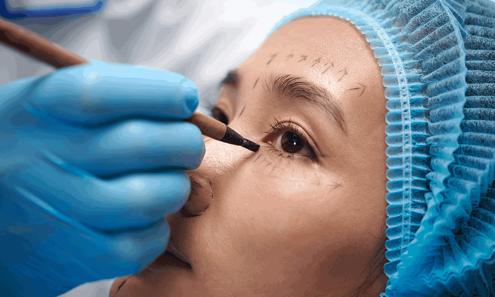 Top Non-Surgical Treatments to Lift Eyelids