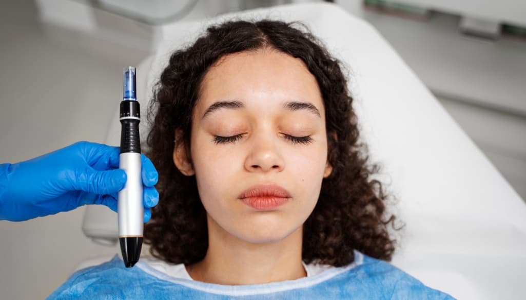 Does Microneedling Work?