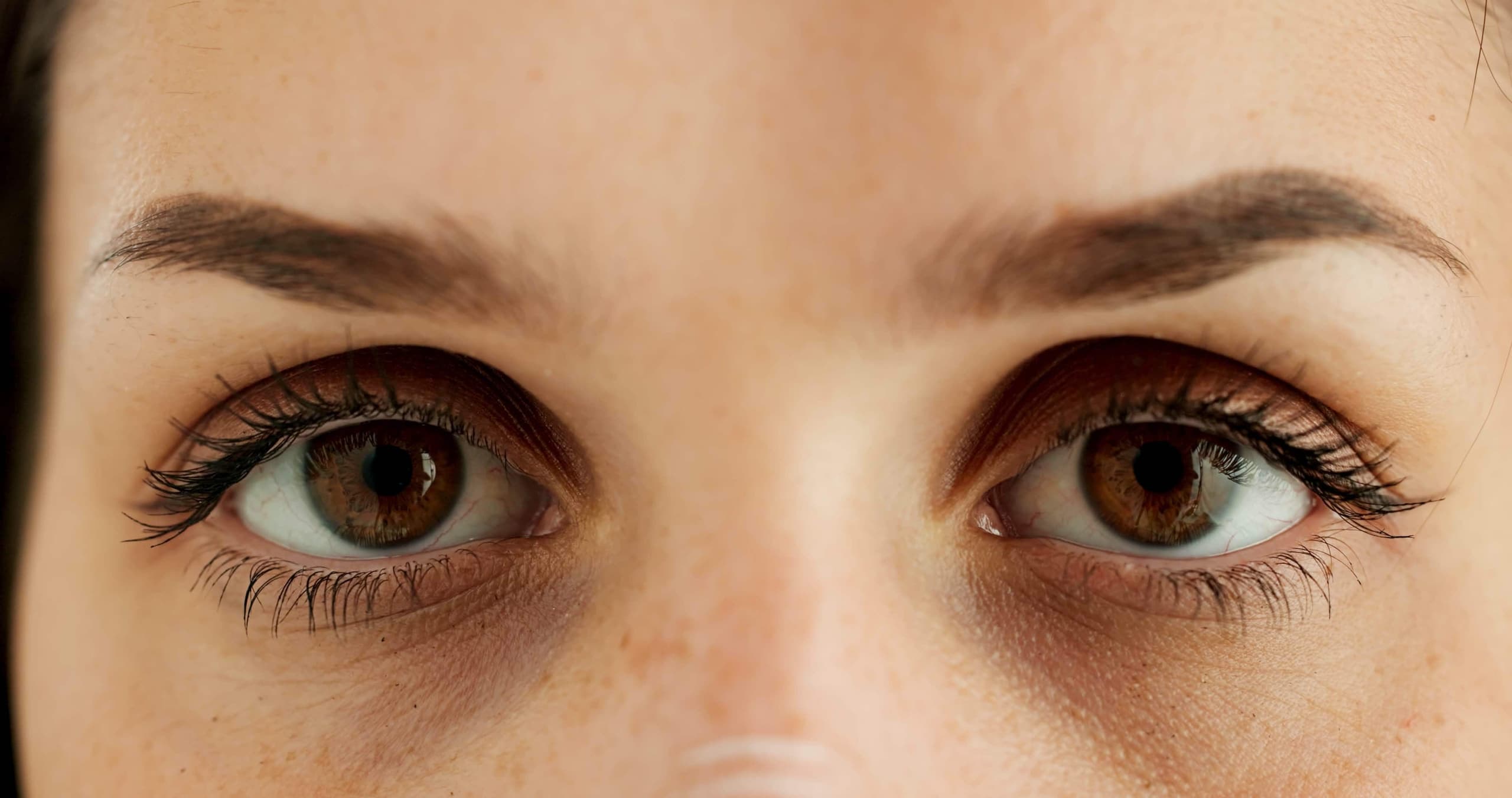 Cure Under Eye Circles: Complete Guide