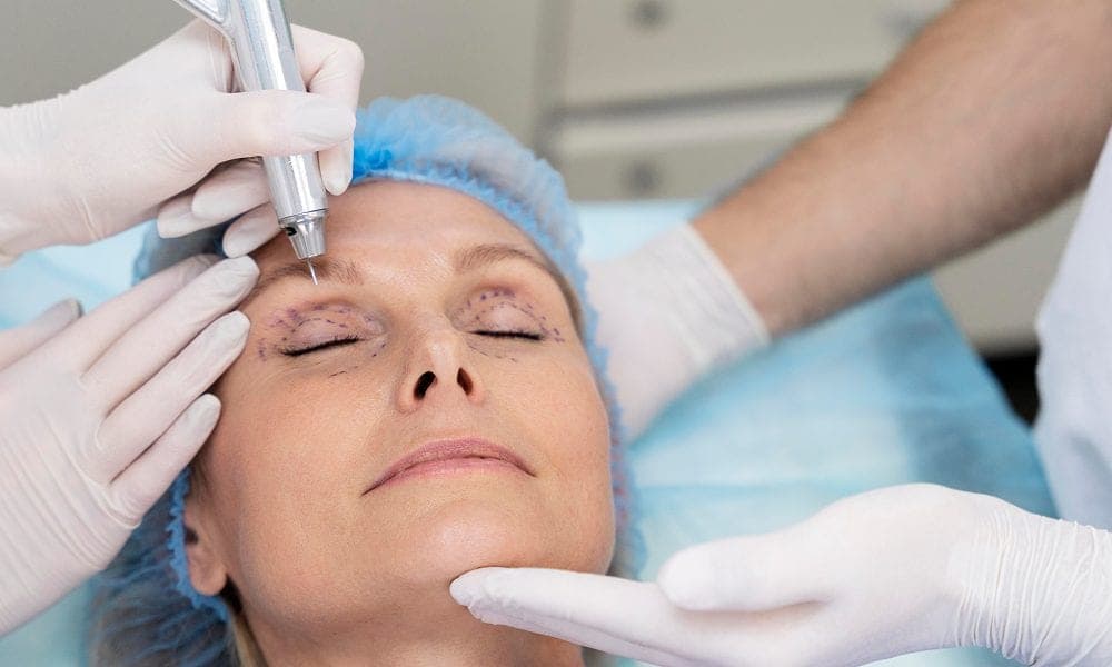 How Much Is a Blepharoplasty in the UK? A Complete Cost Guide