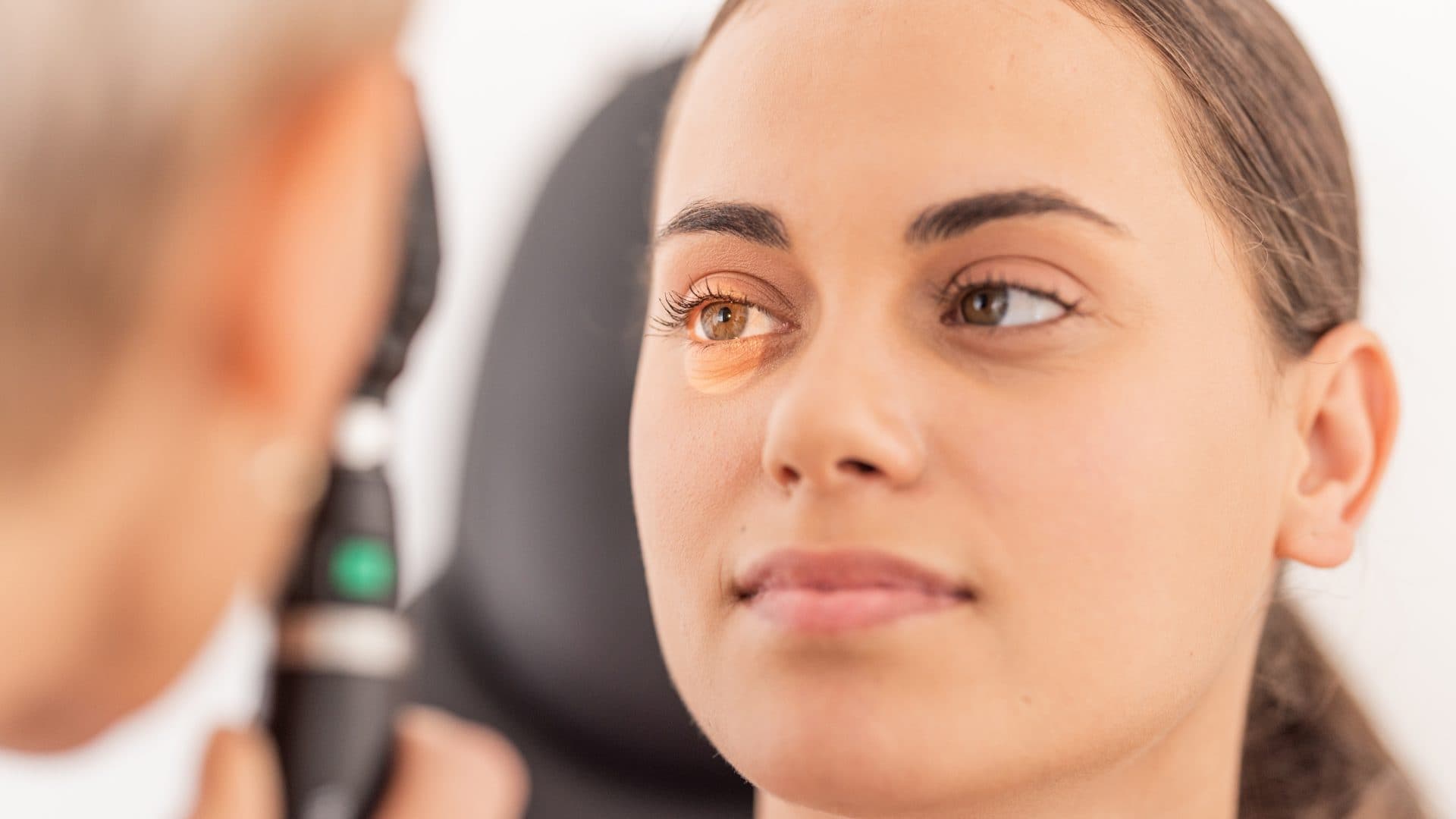 Lower Lid Blepharoplasty