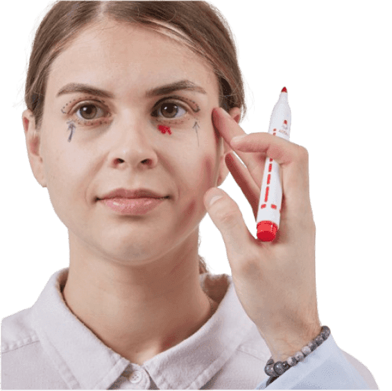 Xanthelasma Removal Surgery