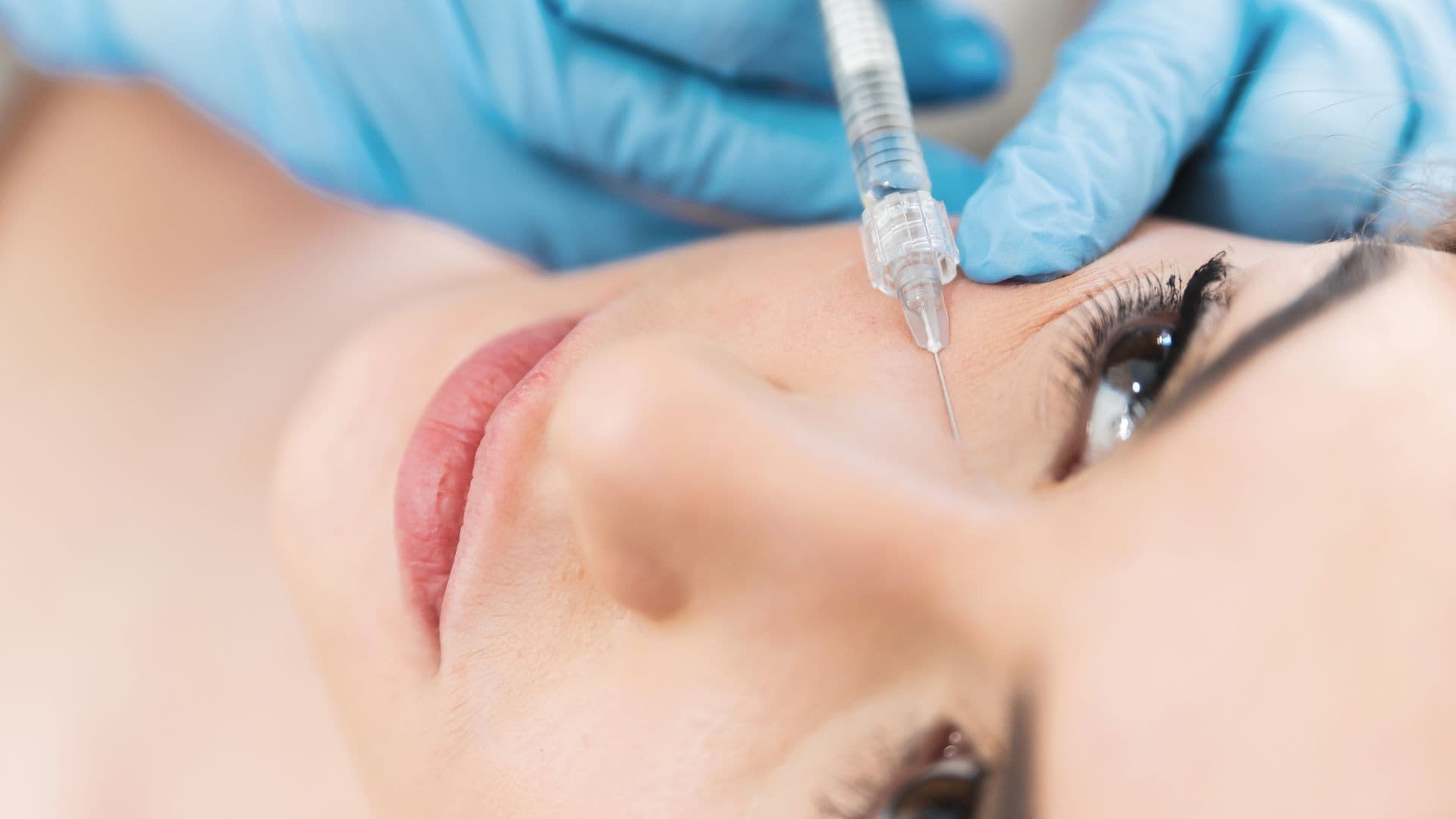 How Long Does Tear Trough Filler Last?