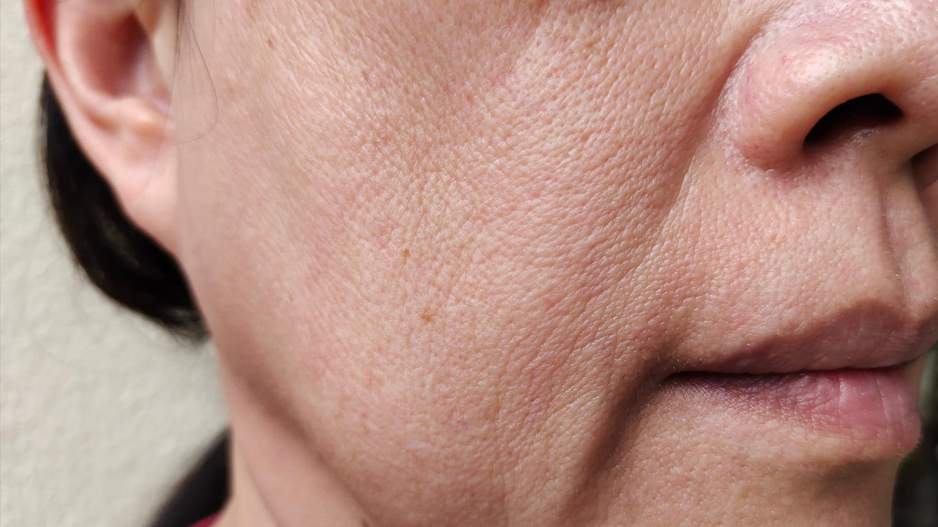 Sagging Jowls: What You Need to Know?