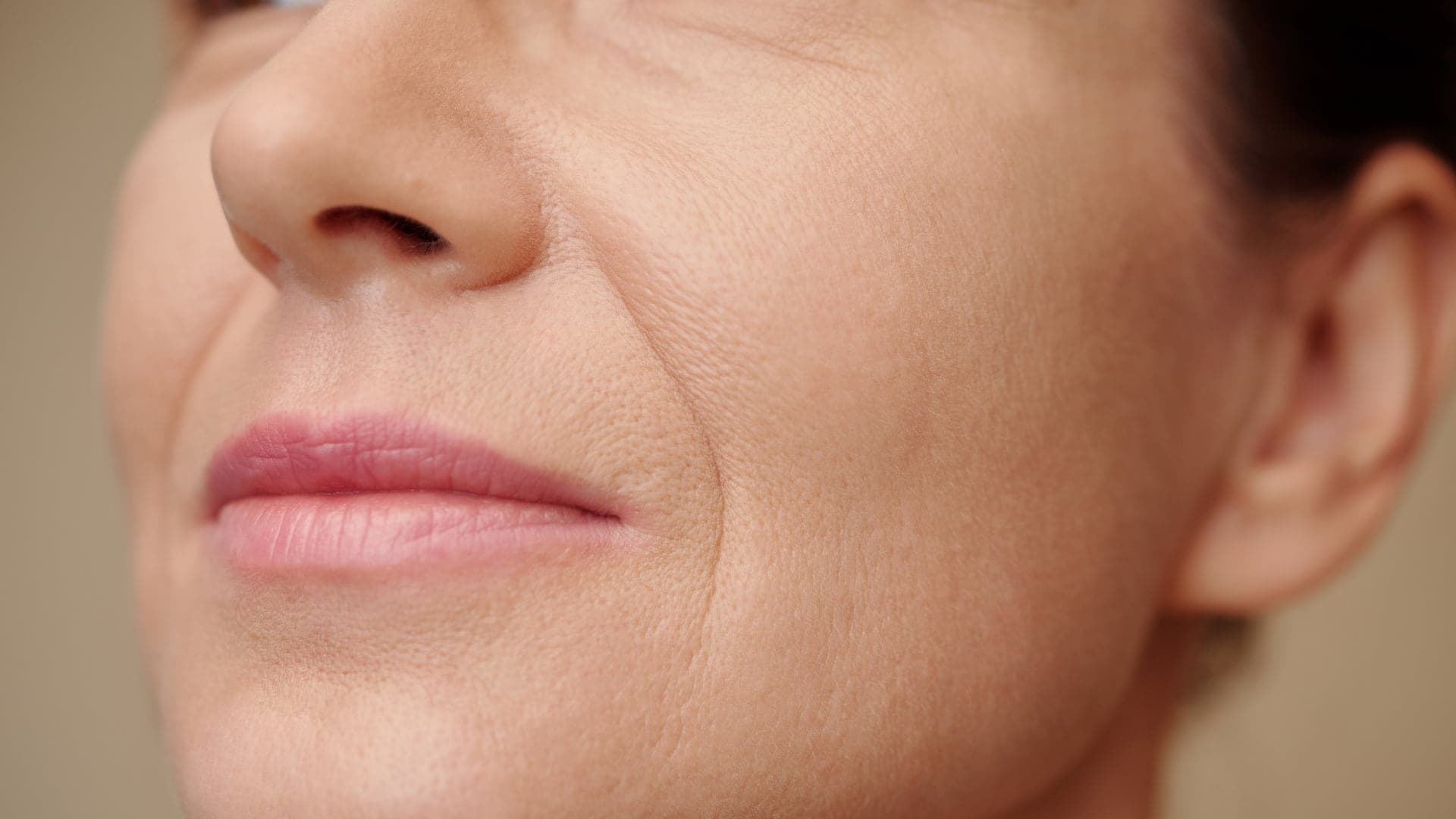 Nasolabial Folds: Causes, Treatments, and Prevention