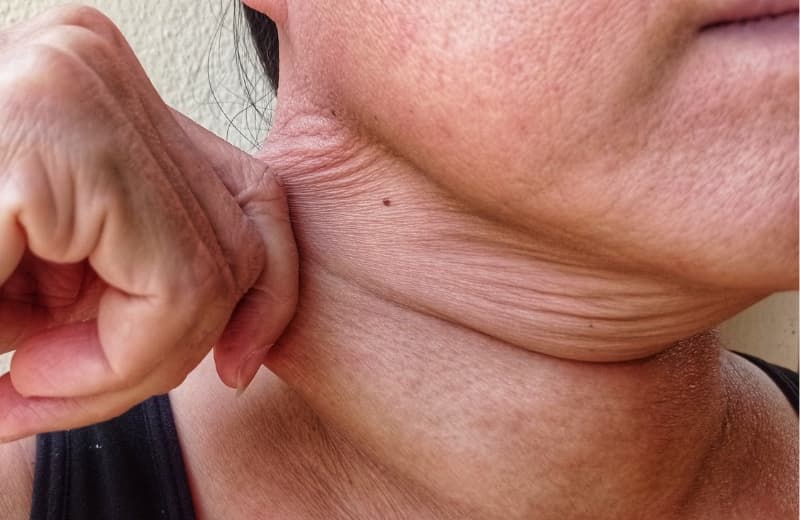 How to get rid of turkey Neck: Complete Guide