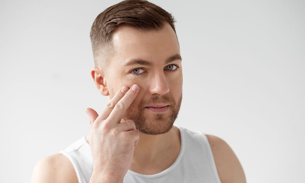 How To Get Rid of Bags Under Eyes in Men?