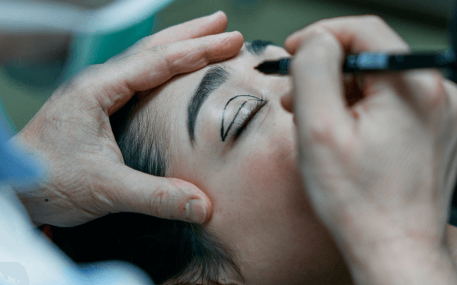 What Is Double Eyelid Surgery and How Is It Different From a Regular Blepharoplasty?