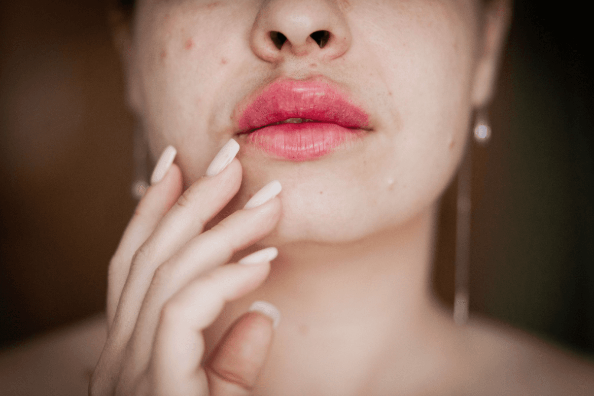 The Skin Barrier Is Damaged: 9 Signs Your Skin Is Asking You to Stop