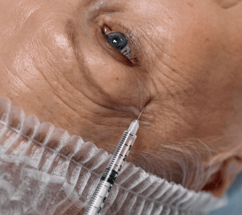 Had Eyelid Surgery or Fillers? Here's What Dr Sabrina Recommends for Your Skin