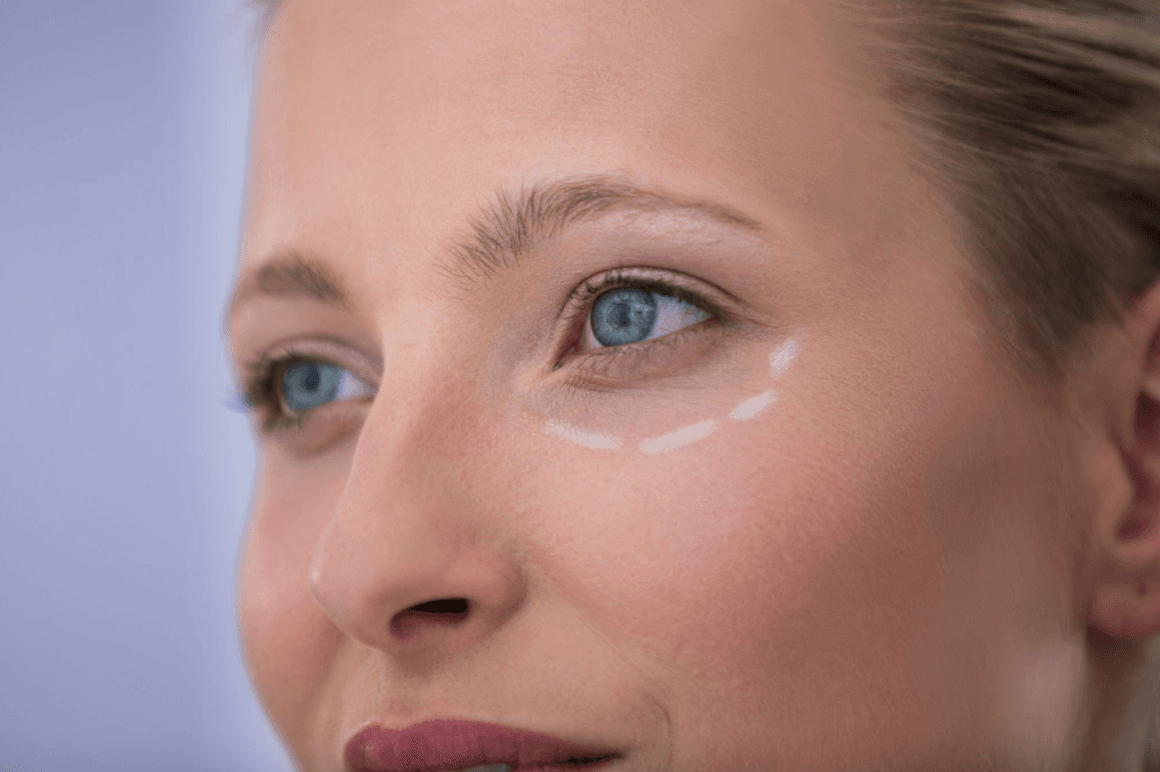 Tear Trough Fillers Before and After: Results, Recovery and Expectations