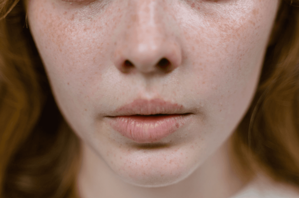 Textured Skin on Face: Causes, Types, and How to Treat It