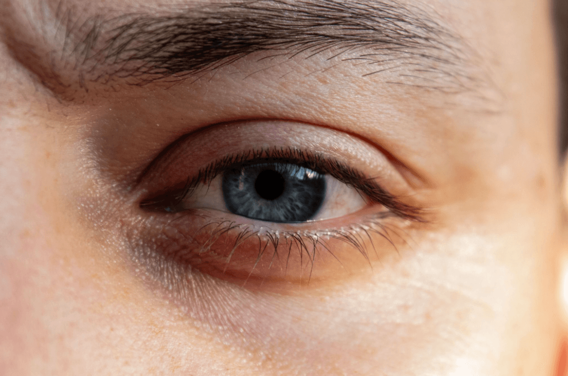 Why Do I Keep Getting a Stye in the Same Eye?