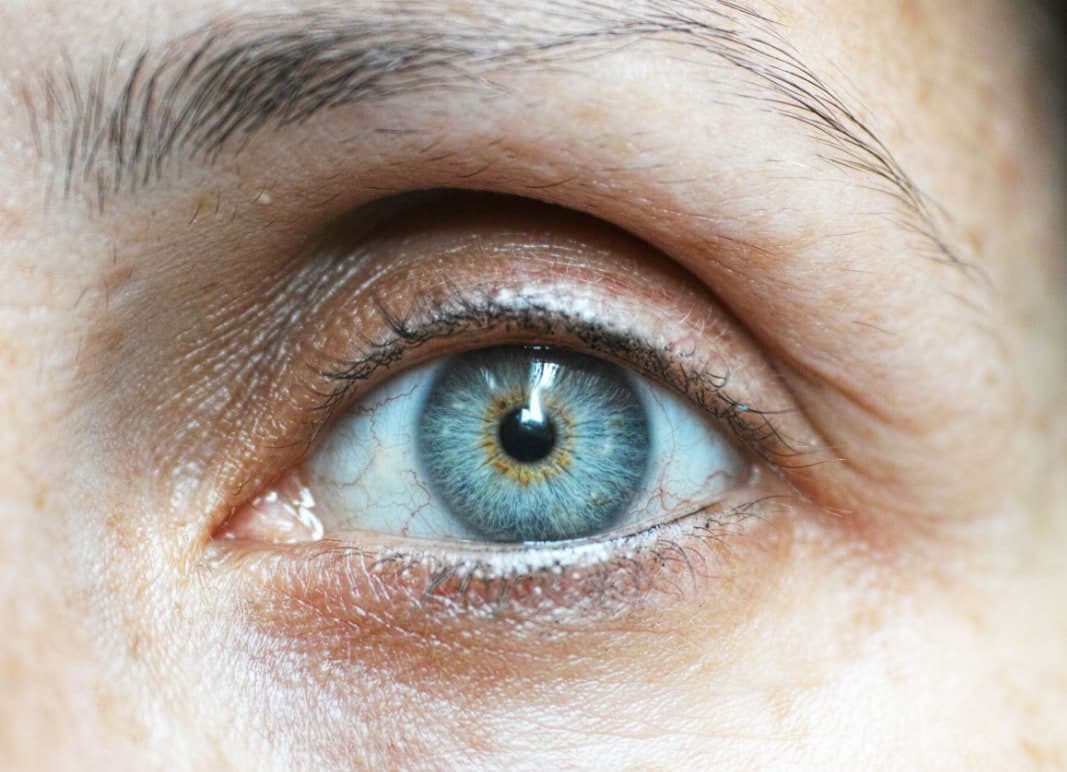 Why Has My Eyelid Suddenly Drooped? Causes, Warning Signs, and When to See a Doctor
