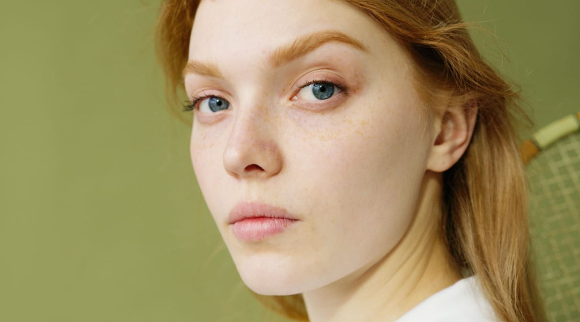 Close-up of a woman with clear, evenly hydrated skin, the improvement in overall skin quality that bio-remodelling aims for rather than added volume