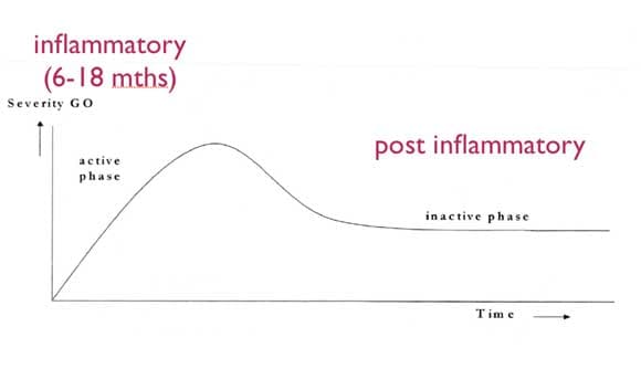 Rundle's curve showing thyroid eye disease severity over time