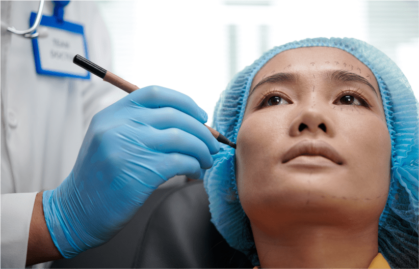 Patient being marked up before double eyelid surgery