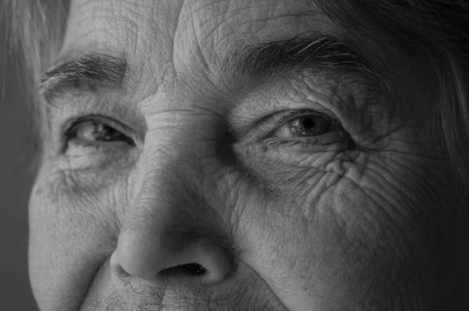 Close-up of an older person's eyes showing the lid and skin changes that come with age