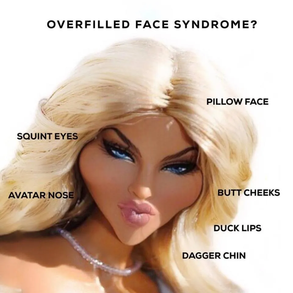 Facial Overfilled Syndrome What It Is And How We Can Help You Treat It Safely Aesthetic 